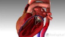Ceren Okyar - Congestive Heart Failure