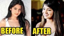 Anushka Sharma Angry Over Her Lips-Cosmetic Surgery News ?