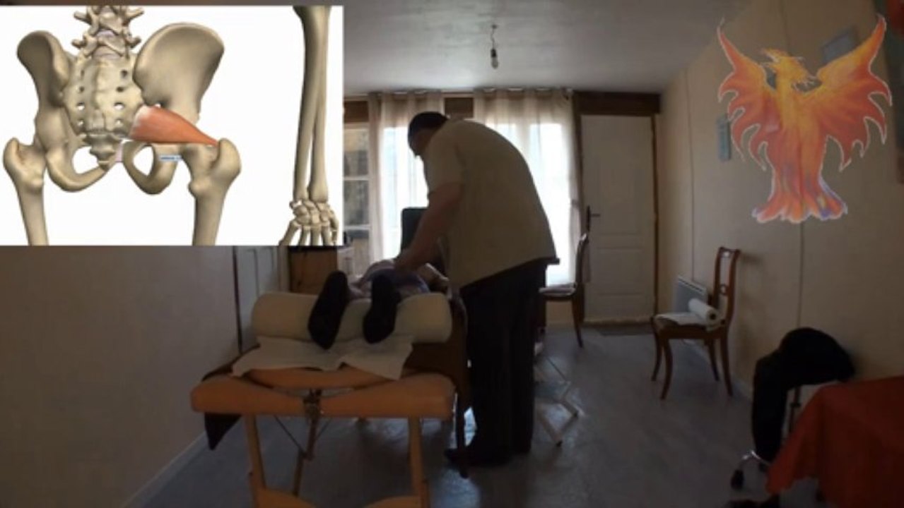 Sciatique traitée en magnetisme et points trigger
