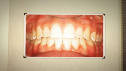 Dallas Orthodontists July2013