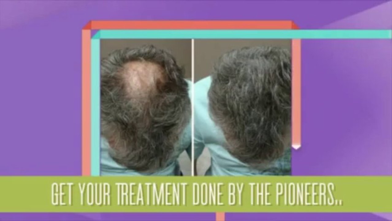 Hair Building Fiber