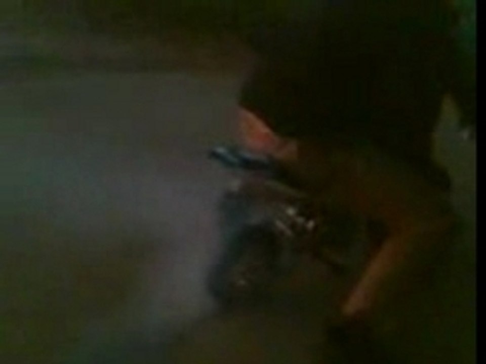 burn pocket
