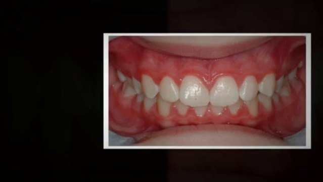 Littleton Orthodontics June2013