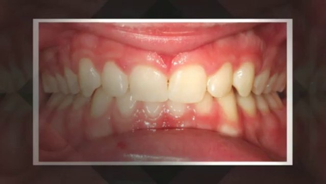 Orthodontics Littleton July2013