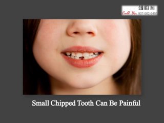 Things To Know About Dental Implants | 907-562-6456
