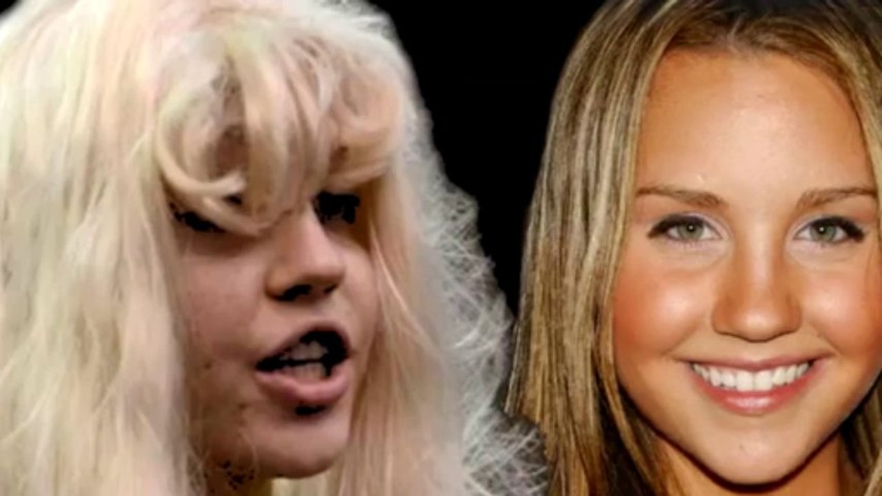 Amanda Bynes - Then to Now Morph ( Shocking ) Changing Face