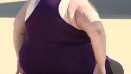 UK reviews medical care for obese patients