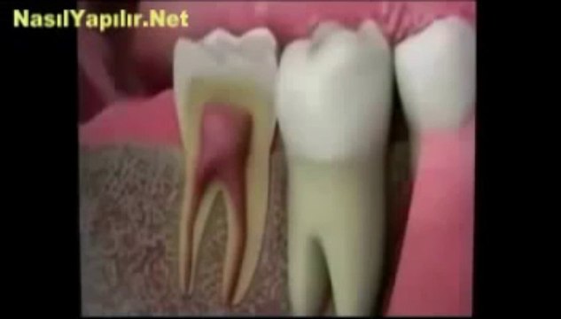 Kanal Tedavisi Nasıl Yapılır_ _ NasılYapılır.Net _