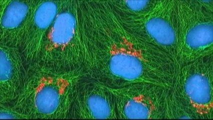 Soixante ans après sa mort, ses cellules continuent de faire avancer la science