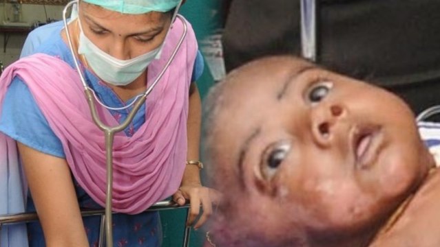 Baby Catches Fire 4 Times, Doctors Cry Spontaneous Combustion
