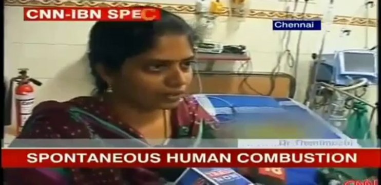 Spontaneous Human Combustion Baby Catches Fire Whenever Sweats