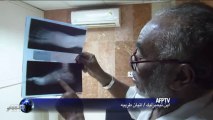 مرضى الالتهاب الفطري يجدون العلاج في السودان