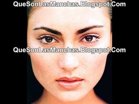 Que Son Las Manchas: Por qué aparecen manchas en la cara o manchas en la piel?