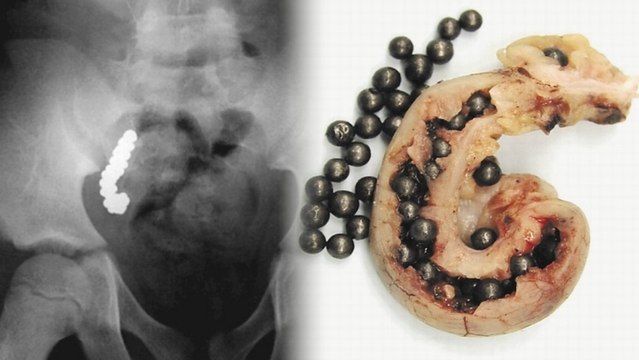 Child's Lead Poisoning Leads to Bizarre Discovery