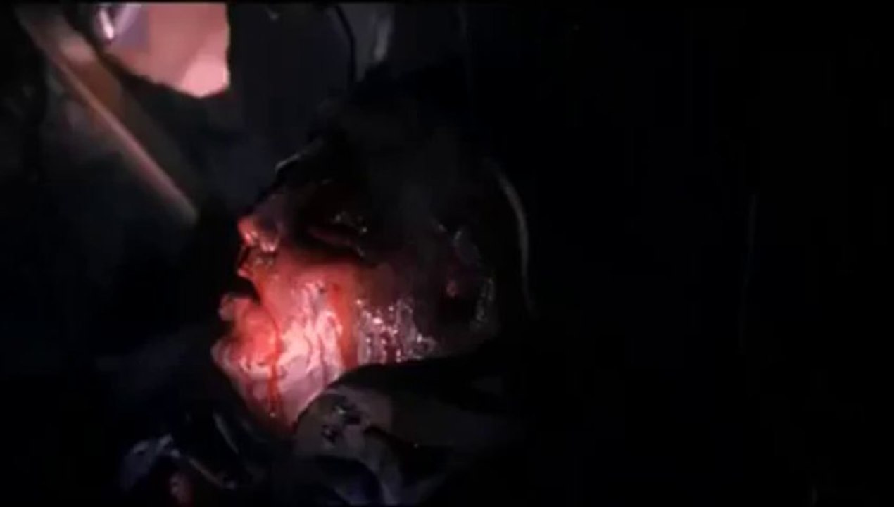 Spiders [PART 2/7] ENGLISH