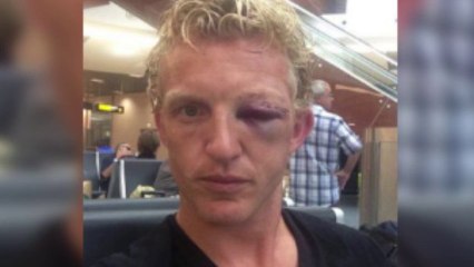 Le choc terrible qui défigura Dirk Kuyt !