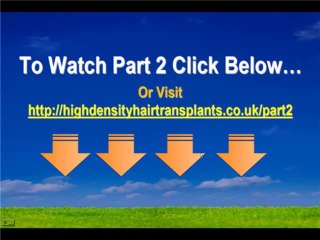 Hair Transplants on the Fast Track