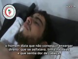 18 Síria, Damasco, Afetados por arma químicas em Adra