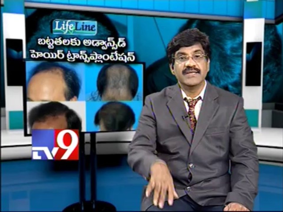 Advanced hair transplantation for Baldness