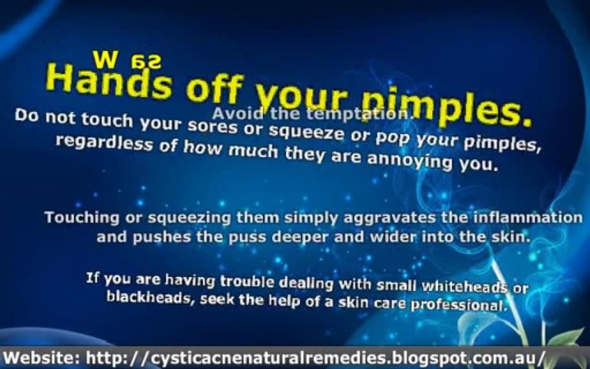 Is Your Acne Driving You Nuts? Try This!