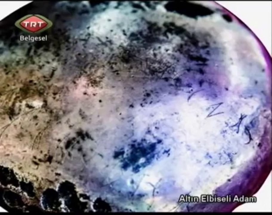 Altın Elbiseli Adam