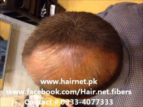 Hairnet Hair building fibers the magic is now available in Pakistan