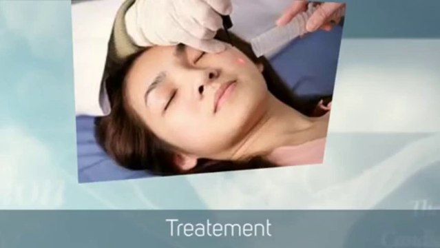 Yeast infection treatment on finding symptoms of yeast infection.