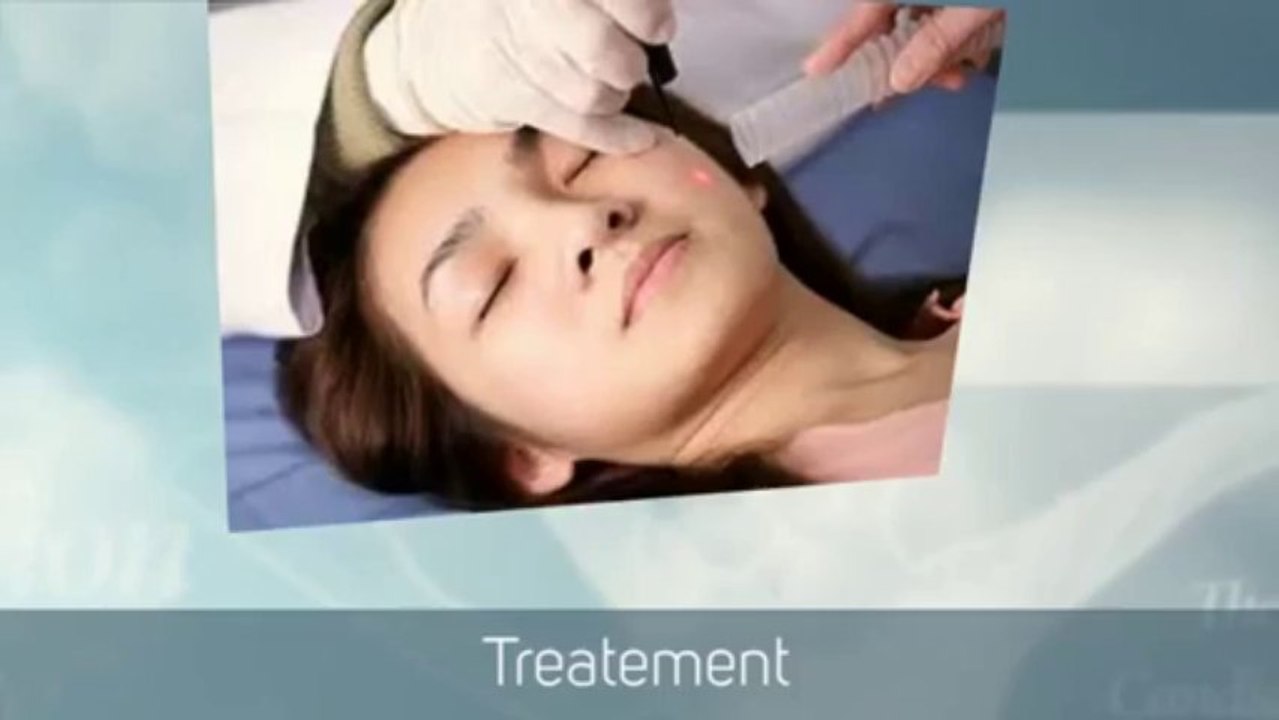 Yeast infection treatment on finding symptoms of yeast infection.