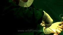 Surgery of Fibroid in Breast-hdv-fx-1-01-7