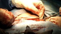 Caesarean section delivery-7