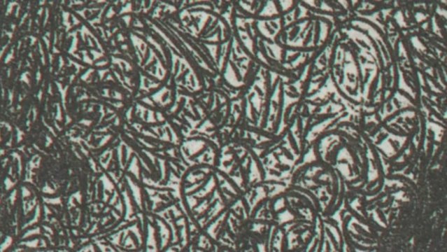 Exposition Markus Raetz