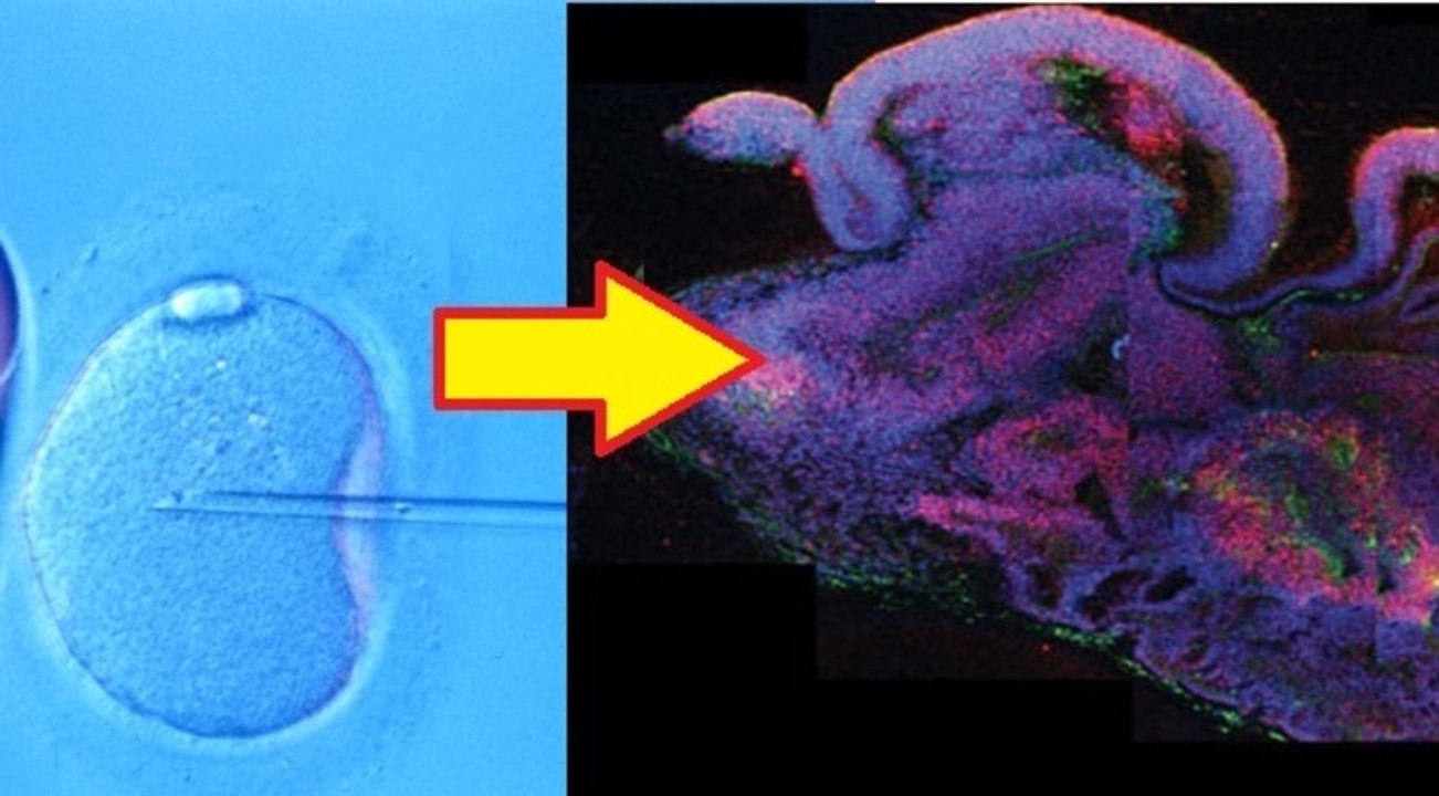 Researchers Build Human "Mini Brains" From Stem Cells