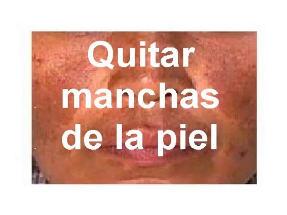 QUITAR MANCHAS DE LA PIEL