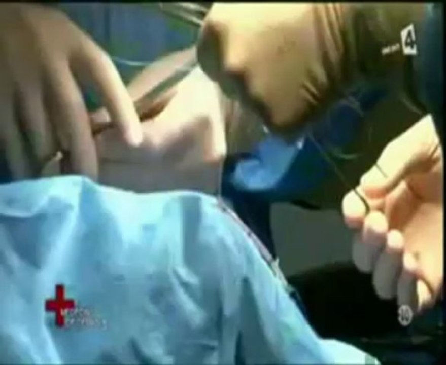 Médecins de demain - Extraits (dérivation, hydrocéphalie, interruption médicale de grossesse)