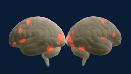 El cerebro enamorado (CUN)