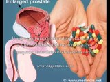 Benign Prostatic Hypertrophy Medical Treatment