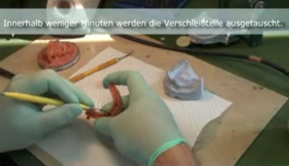 Zahnarztpraxis mit eigenem Zahntechniker - schnelle Abhilfe bei Prothetikproblemen