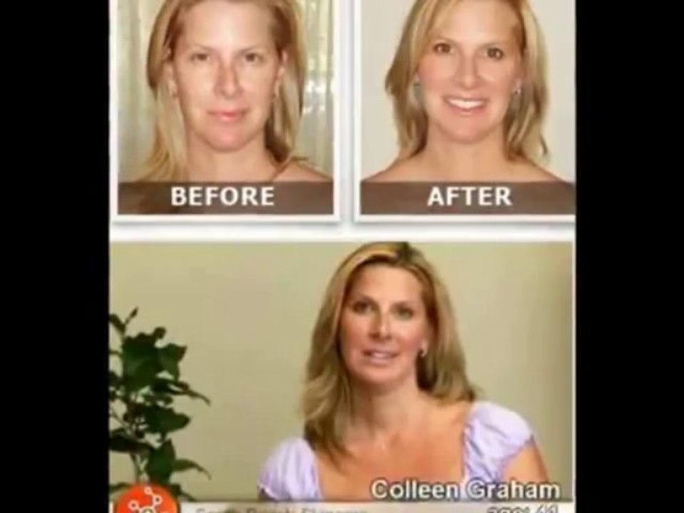 Anti Wrinkle Cream   Lifecell Skin Cream Scam?