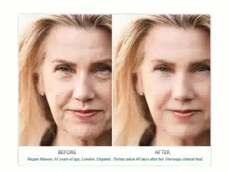 Best Anti Wrinkle Eye Cream - LifeCell Cream