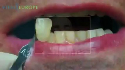 Le meilleur cabinet dentaire en Hongrie