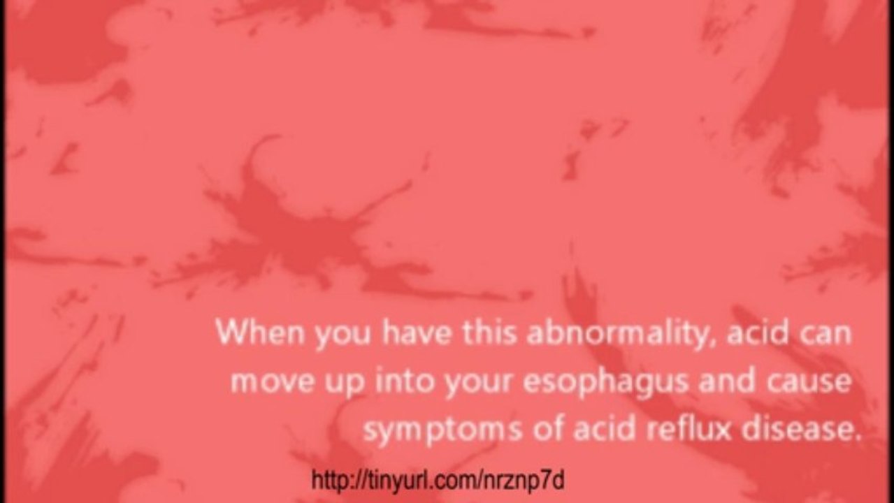 How To Treat Acid Reflux Naturally with Home Remedies Fast and Effective