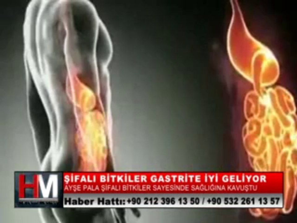 20-AYŞE PALA_GASTRİT2