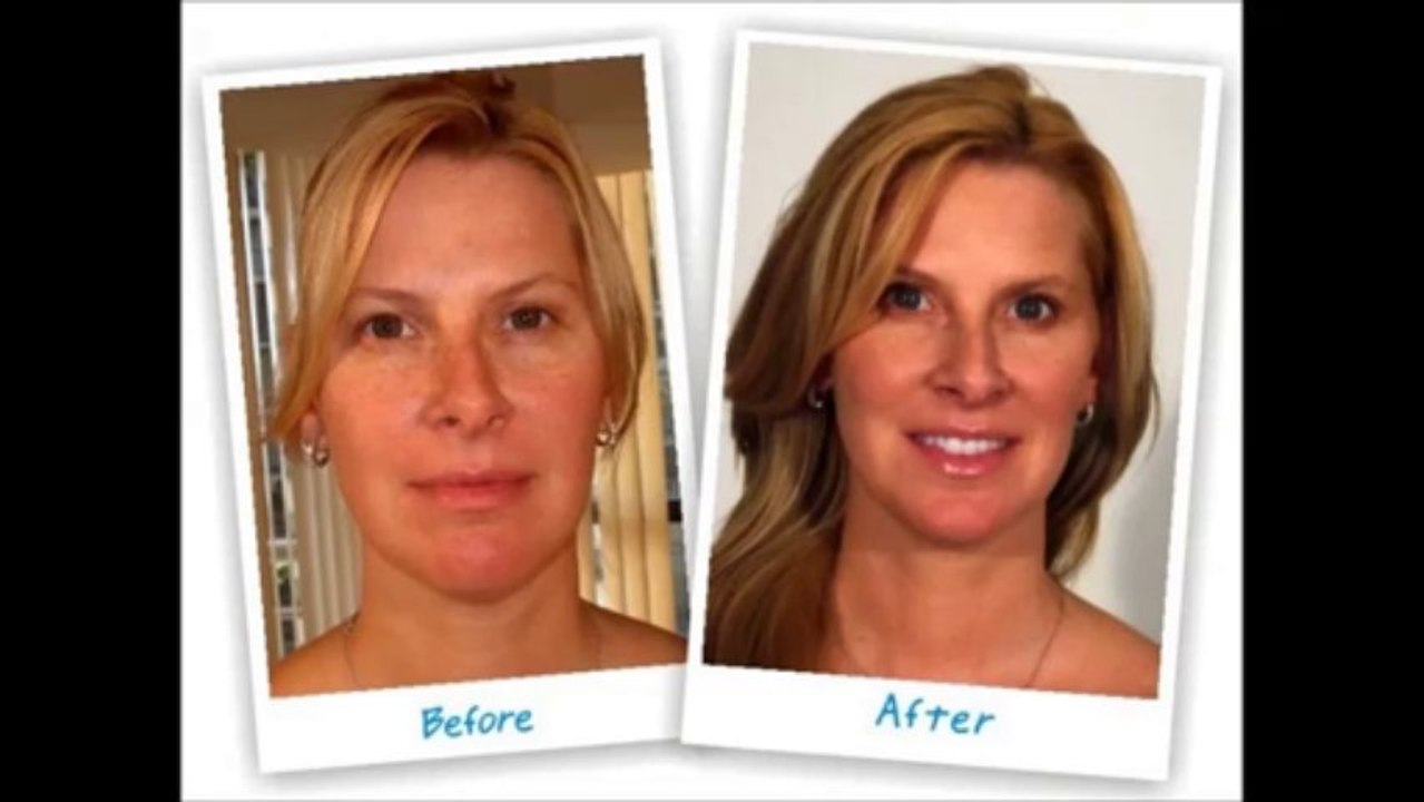 LifeCell Anti Wrinkle Cream - LifeCell Face Cream - LifeCell Skin - Life Cell Eye Cream