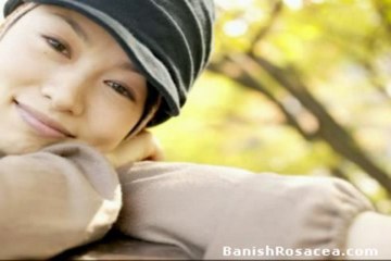 Now YOU Too - Can Treat Rosacea Naturally