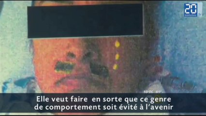 Anesthésiée, on lui colle une fausse moustache