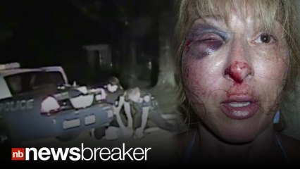 Woman’s Face Disfigured After "Disturbing" DUI Arrest in Florida