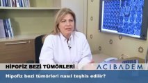 Hipofiz bezi tümörleri nasıl teşhis edilir