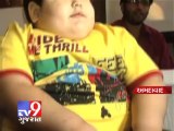 Tv9 Gujarat - World's first bariatric surgery performed on 4 years old boy ,Ahmedabad