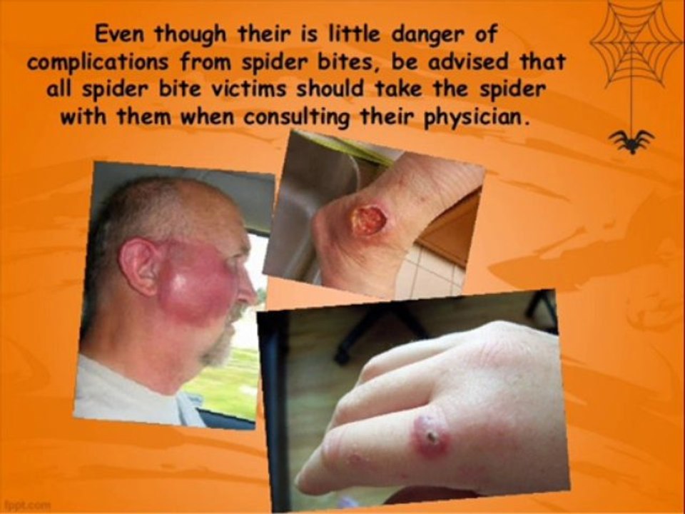 Spider Control