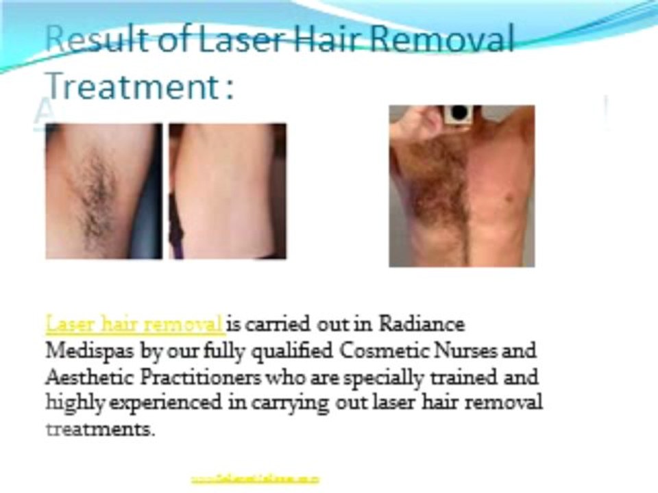 Laser Therapy Removes Hair Permanently